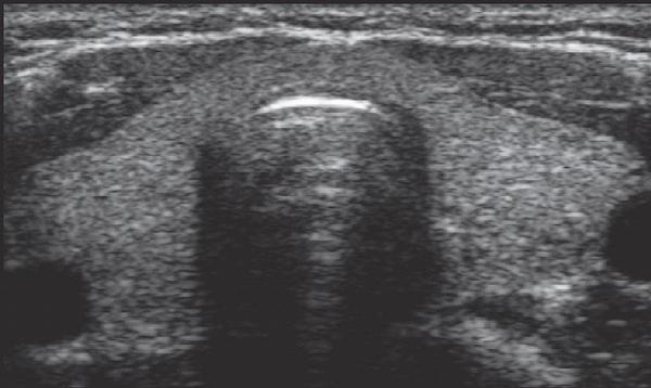 Diagnostika 2 Zobrazovací metody SONO Scintigrafie Další metody EKG Biopsie