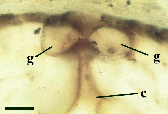 jednobuněčnými rhizoidy a mykorrhizou (4) epidermis - s