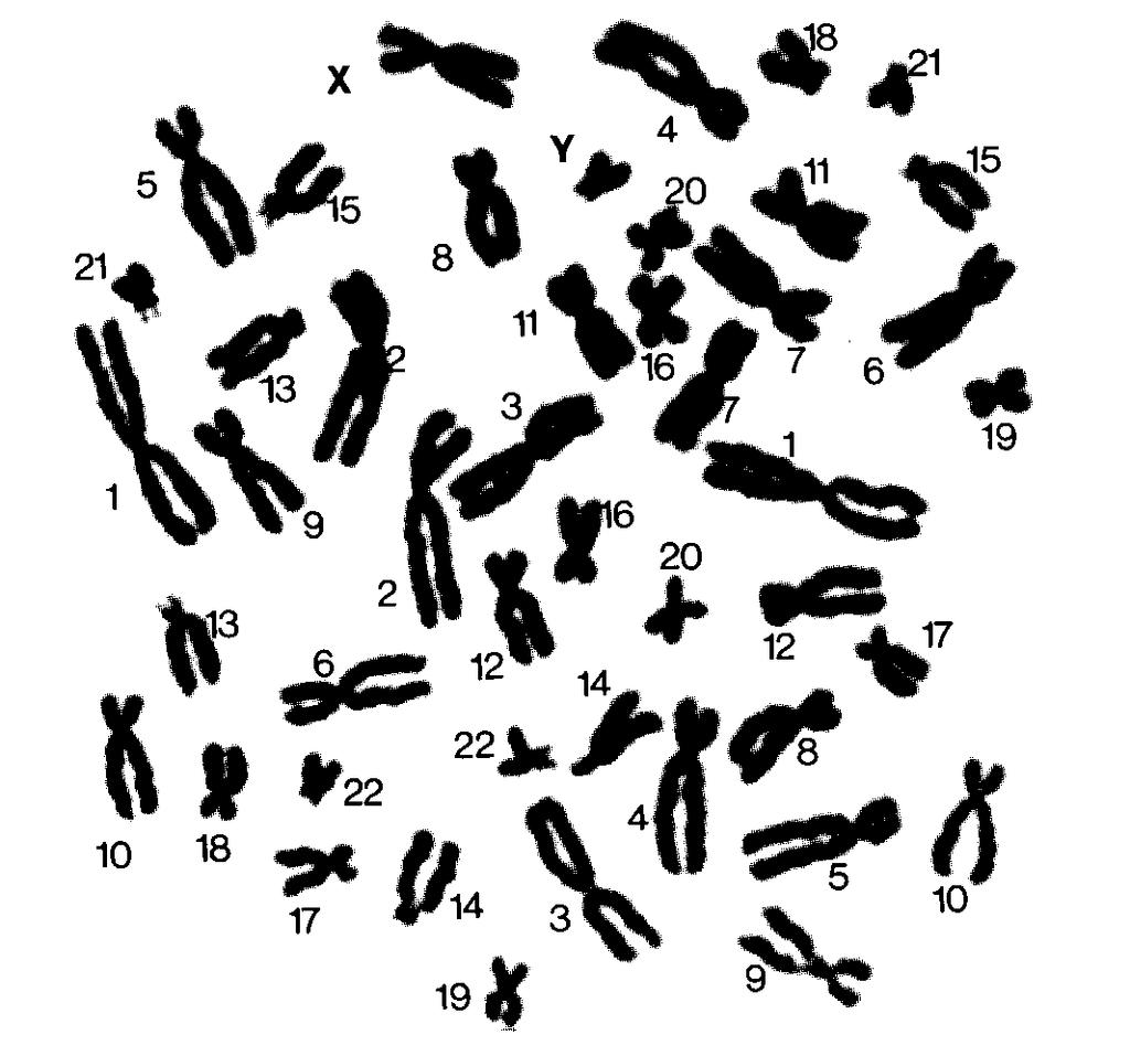 Chromozomová výbava Karyotyp je soubor všech chromozómů v jádře buňky.