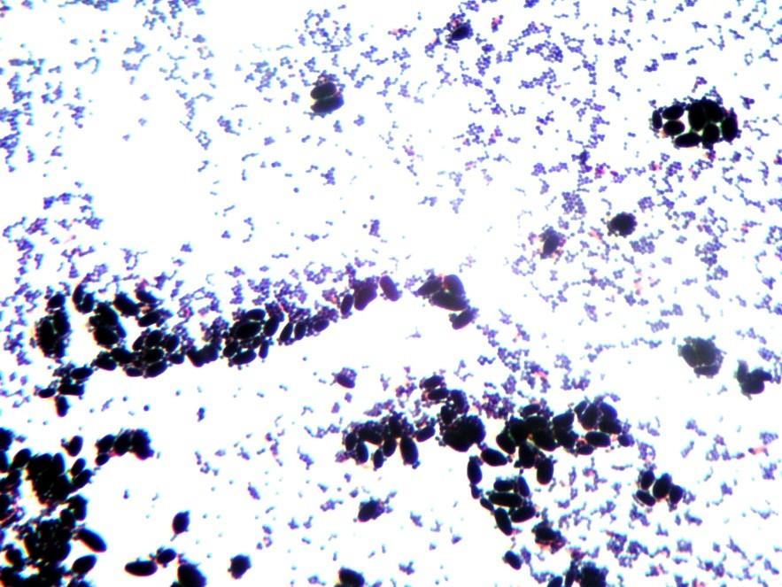 Virologie 20-200nm Bakteriologie