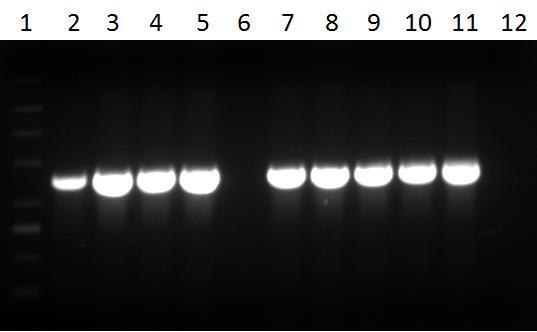 . Obrázek 2: Výsledky genetické detekce genomovaru II u izolátů Bcc z Fakultní nemocnice Hradec Králové; Legenda: 1 - DNA marker 200-1500 bp, 2-5 a 7-10 - pozitivní izoláty, 6 - negativní izolát