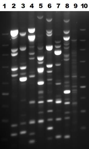 5.4 Typizace kmenů S. matophilia metodou RAPD Genetická příbuznost 32 izolátů S. maltophilia byla stanovena pomocí RAPD metody.