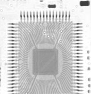 SFT TM: Slice Filter Techniq ue - Definition MatriX patented inspection