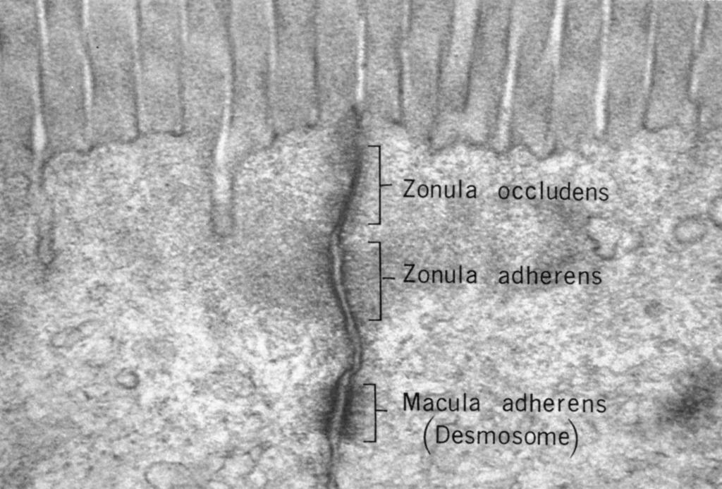 Spojovací komplex Zonula occludens tight junction těsné spojení vymizí mezibuněčný prostor Zonula adherens příchytný