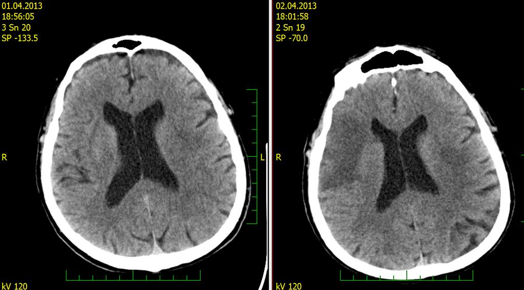 CT diagnostika