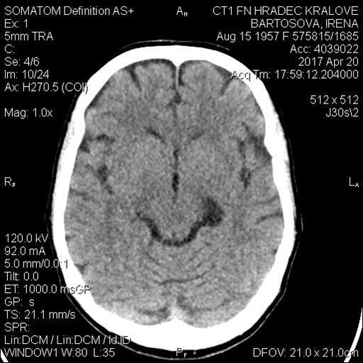 CT CT 9.3.