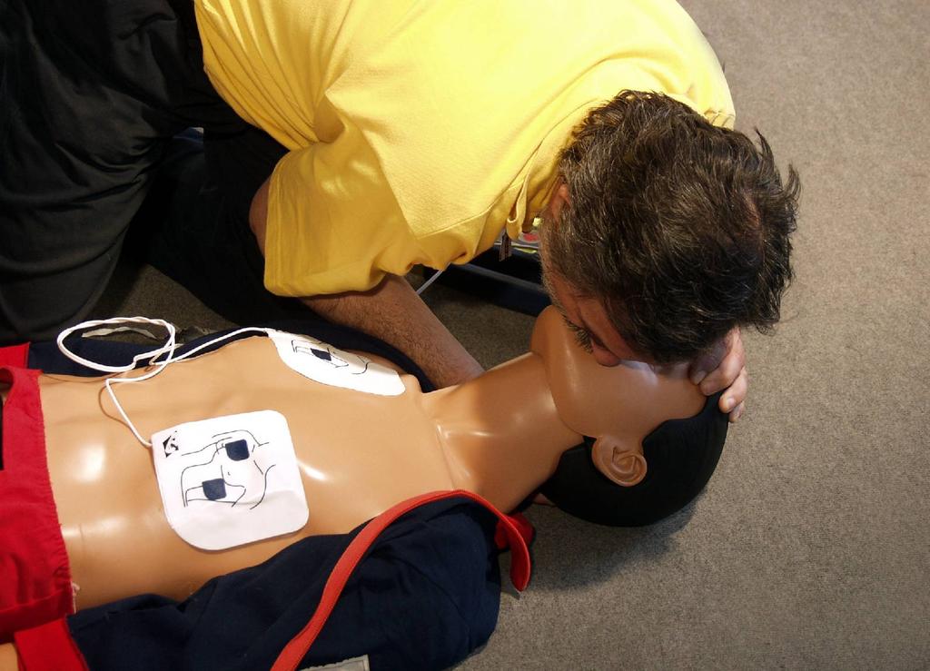 Obr. 60 Umělé dýchání z plic do plic 8 10/min Poznámky k defibrilaci AED Optimální pouze jeden výboj a okamžité pokračování v KPR po dobu 2 min.