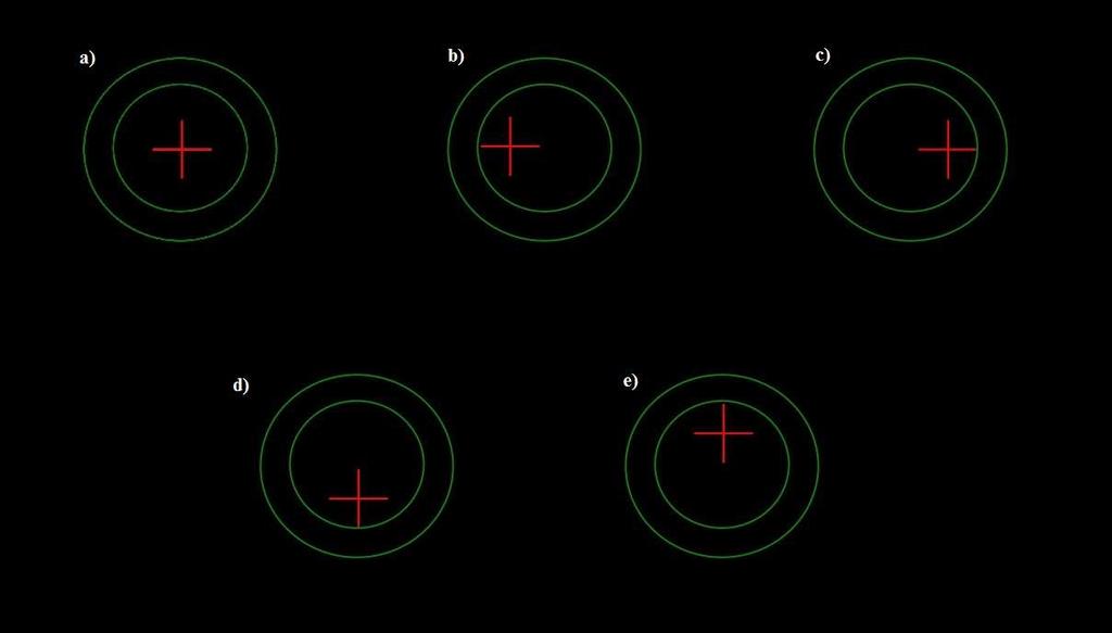 Obrázek 11: Příklady vjemů pacienta: a) ortoforie, b) exoforie, c) esoforie, d) hyperforie vpravo, e) hyperforie vlevo 2.