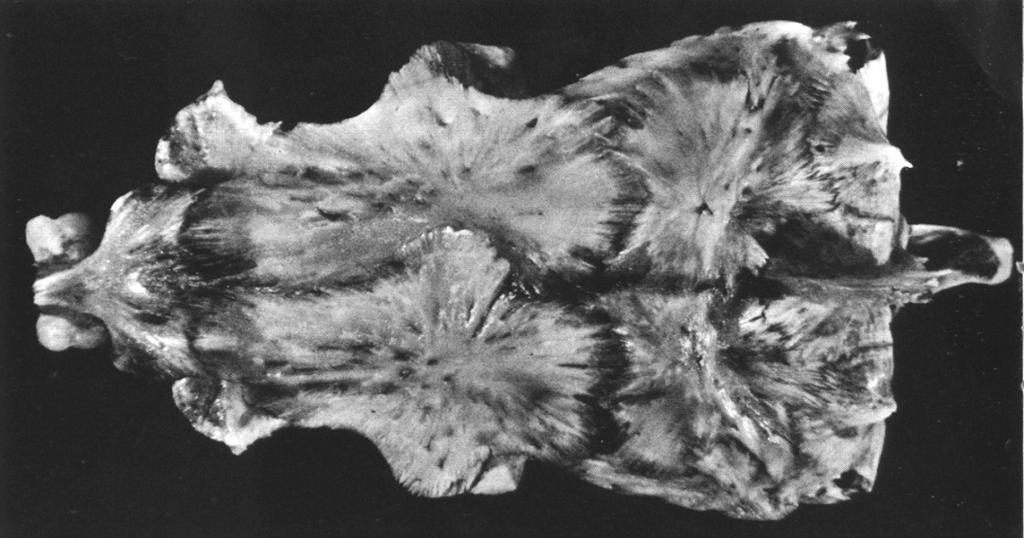 Neurocranium kapra dorzální pohled 2. Etmoideum 3. Praefrontale 4. Frontale 5. Sphenoticum 6. Parietale 7. Supraoccipitale 8. Epioticum 9.