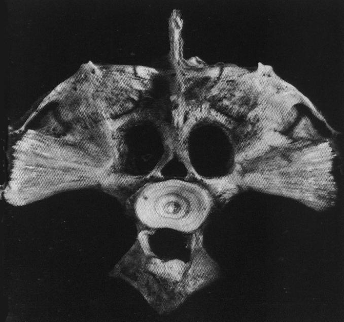 Neurocranium kapra kaudální pohled 7.