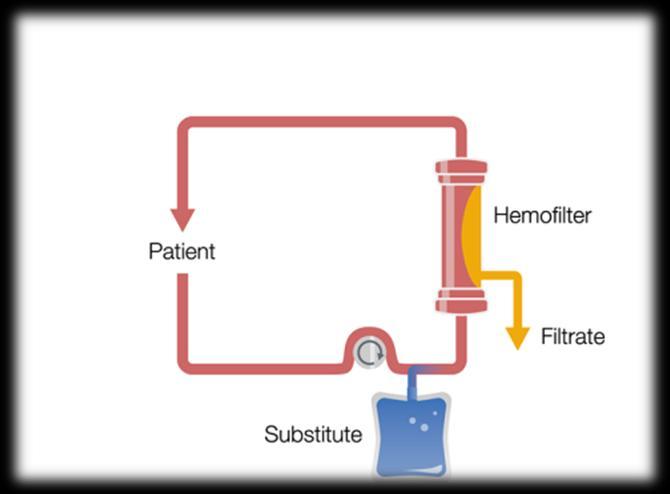 Typy CRRT: CVVH = kontinuální veno-venózní hemofiltrace (continuous veno-venous hemofiltration) léčebná metoda, která k očištění krve se využívá pouze filtraci (konvekce) vzniklý filtrát, který je