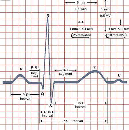Obrázek 7 znázorňuje klasický záznam bioelektrické aktivity srdce. Obrázek 7: EKG křivka s rozměřenými parametry. Změny na EKG křivce se označují jako vlny, kmity či intervaly a segmenty.
