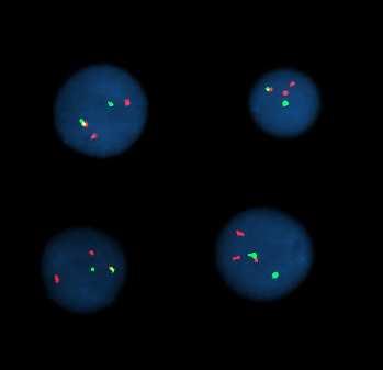 se nachází Centrometric repeat probes: chromosomy