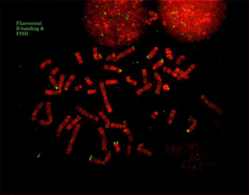 Jedním typem sondy lze obarvit velkou část chromosomu.