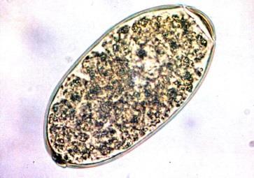 Fasciola hepatica,