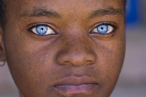 MODRÉ OČI ČLOVĚK Barva oka pigment melanin v duhovce Existuje několik genů odpovědných za