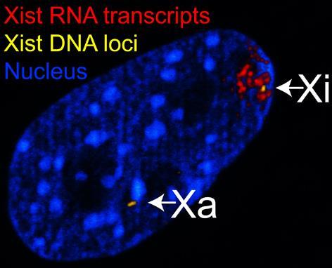 EPIGENETIKA - X-inactivation - každá ženská somatická buňka obsahuje aktivní (Xa) a inaktivní (Xi) chromozom - Xi neexprimuje většinu genů - silencing je způsoben sbalením DNA do heterochromatinu