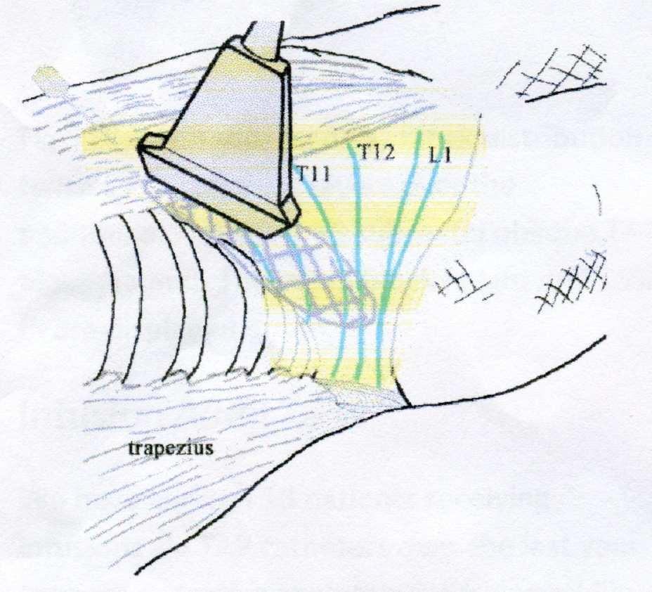 Subcostal