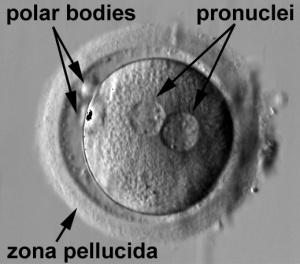 přiblížení prvojader pomocí MT z centriolu spermie rozpad jaderných membrán