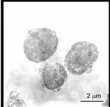 počet: cca 0,02% BM MNC definice: Sca-1 + (stem cell antigen-marker HSC) lin - (lineage-negative) CD45 - (Leukocyte Common