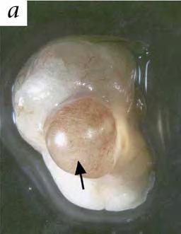 embrya diferenciace ve funkční nefrony a
