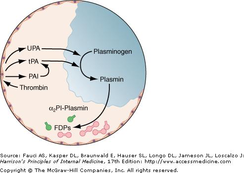 TROMBOLÝZA UPA, urokinase plasmin activator tpa, tissue plasmin