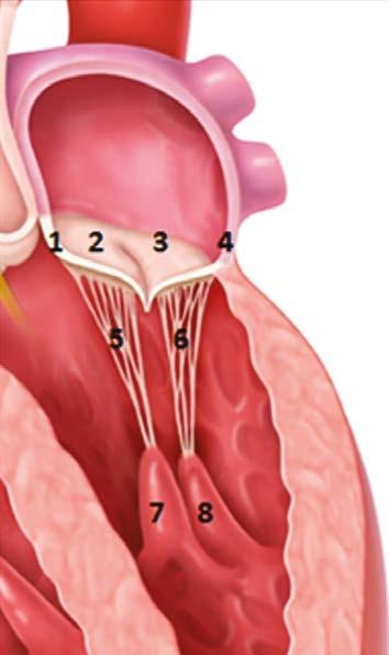 Obr.. Mitrální aparát:. Přední anulus.. Přední cíp (Cuspis anterior).. Zadní cíp (Cuspis posterior).. Zadní anulus. 5, 6. Šlašinky (Chordae tendinae). 7. Přední papilární sval 8.