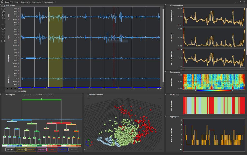 Teleneurologie Bolesti hlavy, Demence, Epilepsie, Roztroušená skleróza Vesměs jde o různé typy vzdálených konzultací Do e-health můžeme zařadit i automatickou nebo