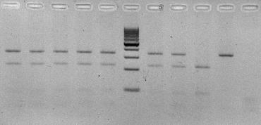 Štiepenie pomocou HhaI 1) Amplifikácia sekvencie DNA z 5 regiónu SNRPN génu s dĺžkou 408bp. 2) Nested PCR - amplifikácia kratšieho úseku SNRPN génu s dĺžkou 340bp.