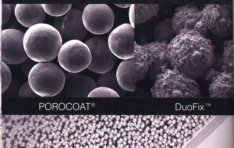 Hydroxyapatitový povrch Bioaktivní Bionertní i osteokonduktivní Nejvíce kompatibilní materiál Podporuje růst