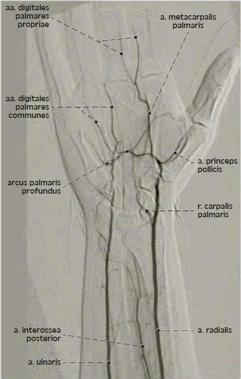 Arcus palmaris superficialis