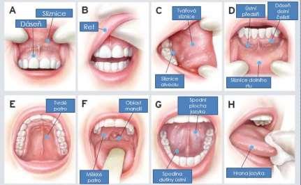 Obrázek 5 Preventivní samovyšetření dutiny ústní zdroj: http://www.stlawrencedentistry.