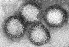 RNA obalené viry: 16.