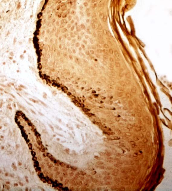 Okulokutánní melanin Kůže, vlasy, vousy Duhovka a sítnice oka Nadledviny leptomeningy Intracelulárně v melanosomech