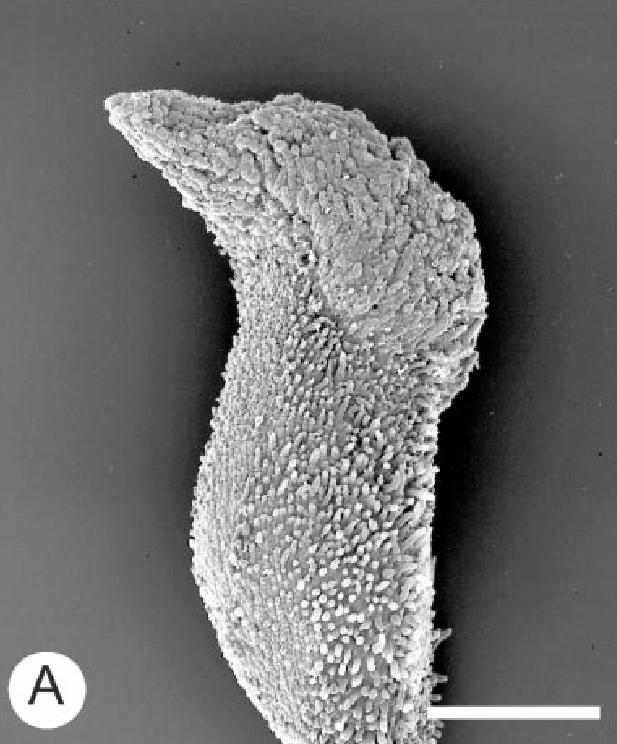 Gyneceum apokarpní, plodolistů nejčastěji 5 nahoře neuzavřených s mohutnými