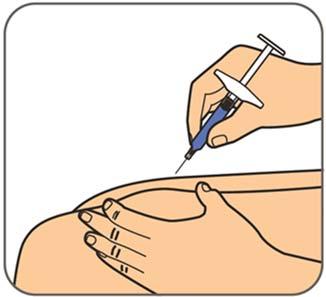 Krok 4: Jemným stiskem sevřete kožní řasu v očištěném místě pro vpich injekce.
