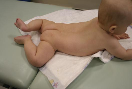 vzpřímení (sledujeme 6tý, 3M, 4,5M, 6M a dosažení