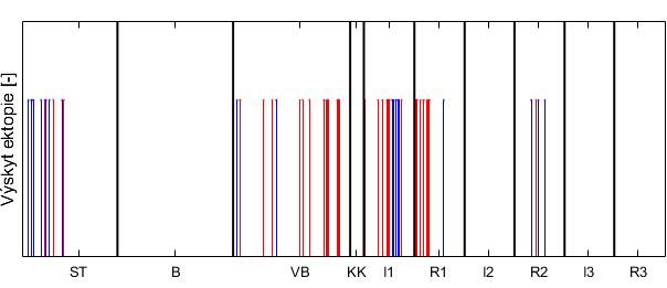 Obr. 19 Výskyt ektopií (modré čáry - SPB, červené čáry - PVC) v rámci všech jednotlivých fází (STstabilizace, B-barvení, VB vymývání barviva, KK-krátká kontrola, I-ischemie, R-reperfuze)ve všech