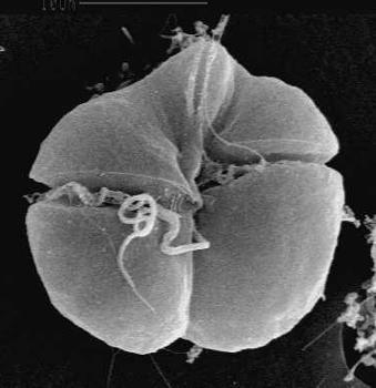 piscicida cysty na dně zoospóry - polykají plankton (krádež chloroplastů), produkce toxinu,