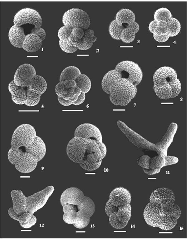plankton: Foraminifera granuloretikulopodia síť výběžků cytoplazmy, dýchání, lapání potravy,