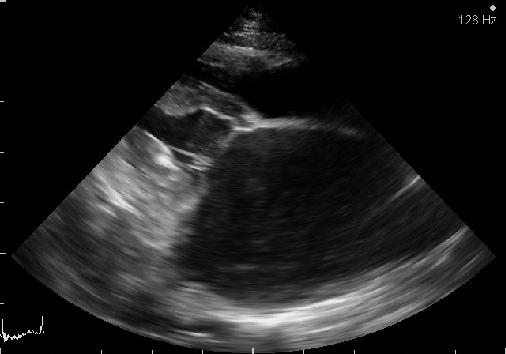 KARDIOMYOPATIE KOČEK Všechny příčiny HCM nejsou zatím identifikovány Předpokládá se genetický základ Prevalence u