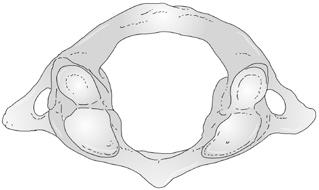 transversi, 9 sulcus nervi spinalis 1 2 3 9 5 8 7 6 8 1 Obr. 1.. Atlas. 1 tuberculum post.