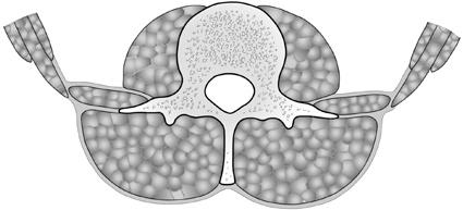 Anatomické poznámky 21 7 1 2 3 6 5 Obr. 1.16. Fascia thoracolumbalis. 1 m. transver sus abdominis, 2 m. obliquus abdominis internus, 3 m. obliquus abdominis externus, m. quadratus lumborum, 5 m.