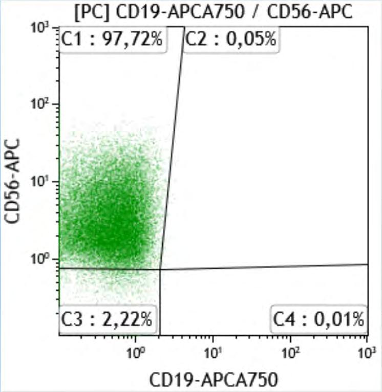 Plazmocytární leukémie N PC (CD19+CD56 ), A PC (CD19 CD56+/CD19 CD56 /CD19+CD56+)