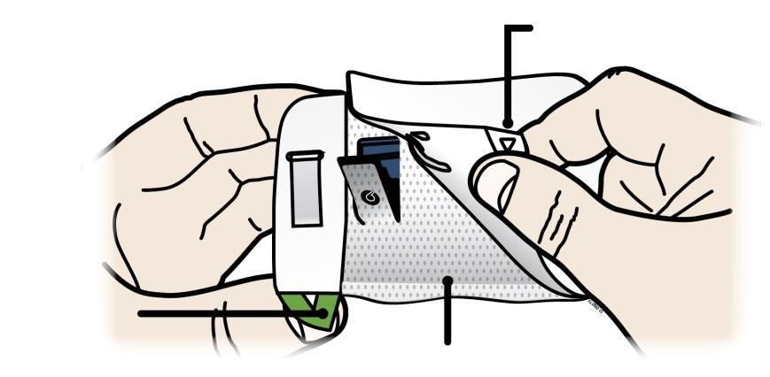 3. krok: Injekčná aplikácia J Odtrhnite obe zelené pútka a ukáže sa lepiaca náplasť.
