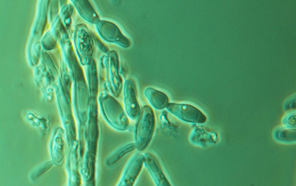 Non-Saccharomyces kvasinky 15 Brettanomyces (Dekkera) poprvé izolována v roce 1904 (N.H. Claussenem v dánském pivovaru Carlsberg).