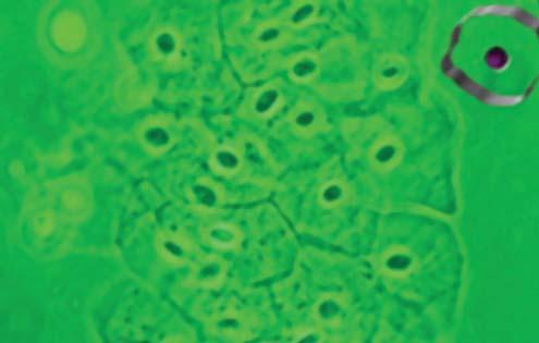 nezralý metaplastický dlaždicový epitel. Diferencované keratinocyty zralého dlaždicového epitelu leží ve třech vrstvách (obr.