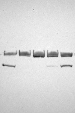 Protein 14-3-3 K+ K- V- V+ V+ Western blot vyšetření CSF 2