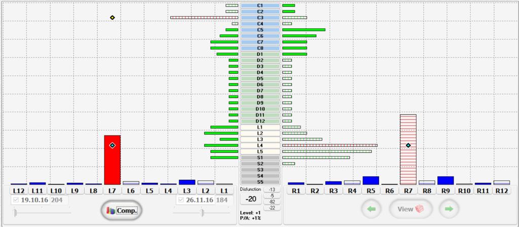 vyšetření. Obr. 3 - Graf kontrolního vyšetření CK dne 26. 11. 2016 Na obrázku 4 je vidět provnání výsledků funkce GRAF diagnostik vstupního a kontrolního vyšetření.