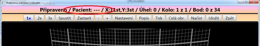 6 Prohlížení již uložených dat Pokud je potřeba pouze prohlédnou některá již dříve uložená měření, tak není nutno na hlavním dialogu aplikace vybírat žádného pacienta.